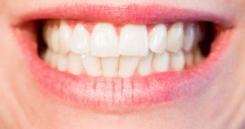 Cómo mantener los dientes sanos en verano