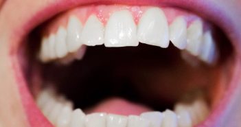 Qué es la gingivitis y cómo prevenirla gingivitis