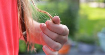 La alopecia en mujeres: causas y tratamiento alopecia