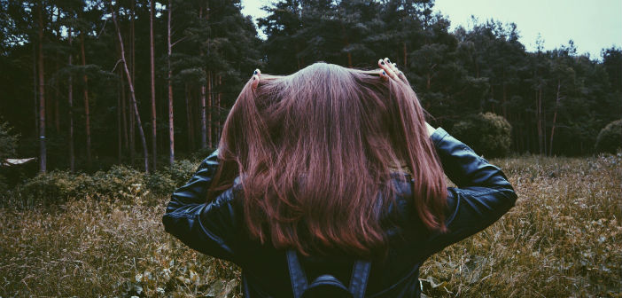 alopecia